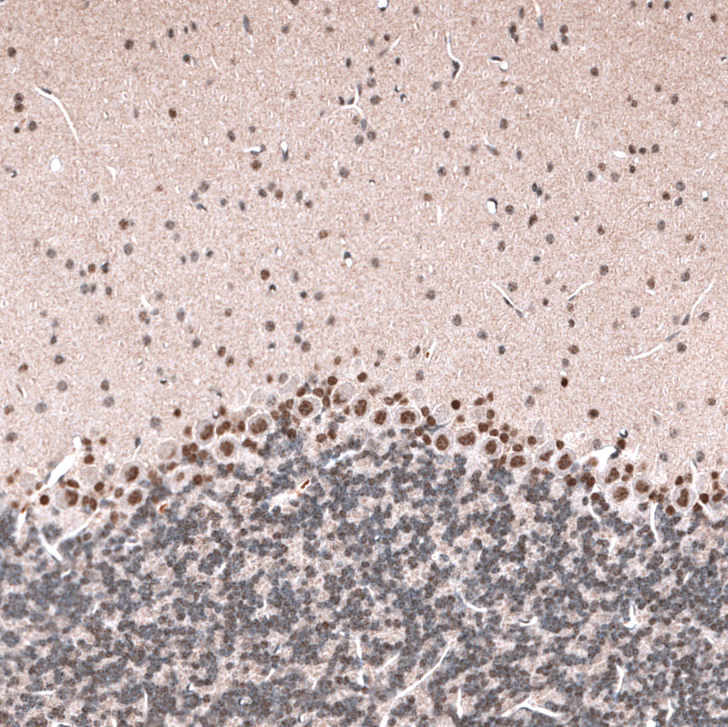 Atlas Antibodies Anti-GLI1 Antibody