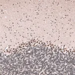 Atlas Antibodies Anti-GLI1 Antibody