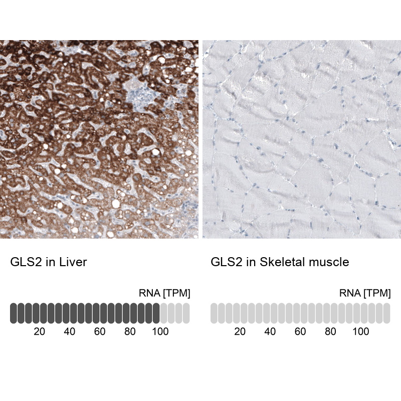 Atlas Antibodies Anti-GLS2 Antibody