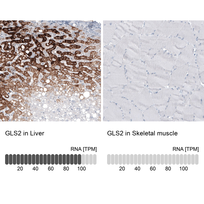 Atlas Antibodies Anti-GLS2 Antibody