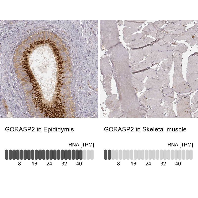 Atlas Antibodies Anti-GORASP2 Antibody