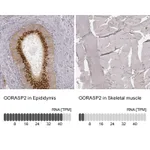 Atlas Antibodies Anti-GORASP2 Antibody