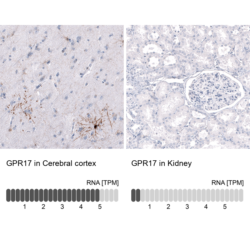 Atlas Antibodies Anti-GPR17 Antibody