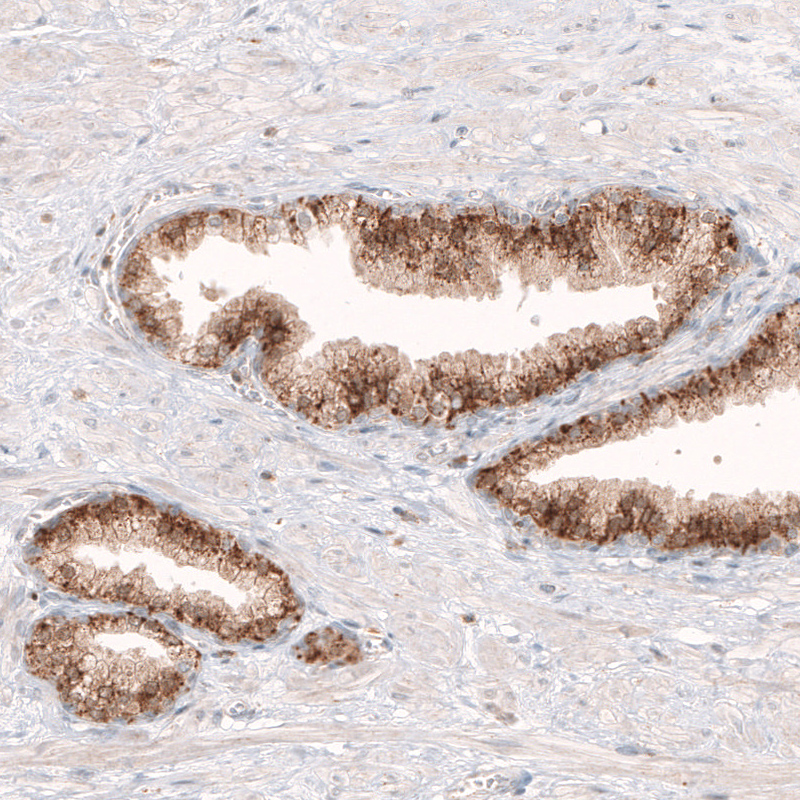 Atlas Antibodies Anti-GRN Antibody