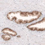 Atlas Antibodies Anti-GRN Antibody