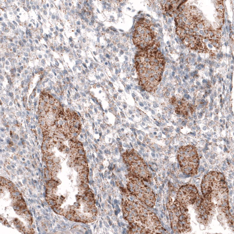 Atlas Antibodies Anti-GRN Antibody