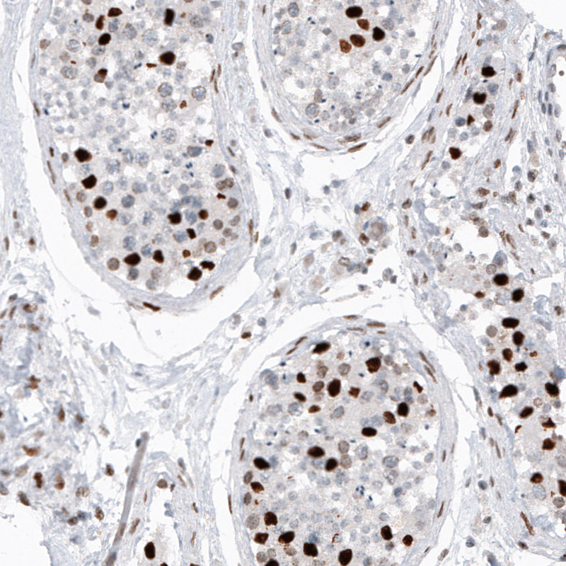 Atlas Antibodies Anti-H2AFY2 Antibody