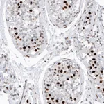 Atlas Antibodies Anti-H2AFY2 Antibody