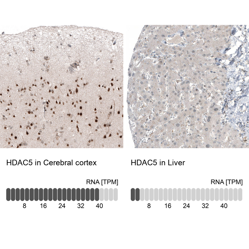 Atlas Antibodies Anti-HDAC5 Antibody
