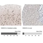 Atlas Antibodies Anti-HDAC5 Antibody