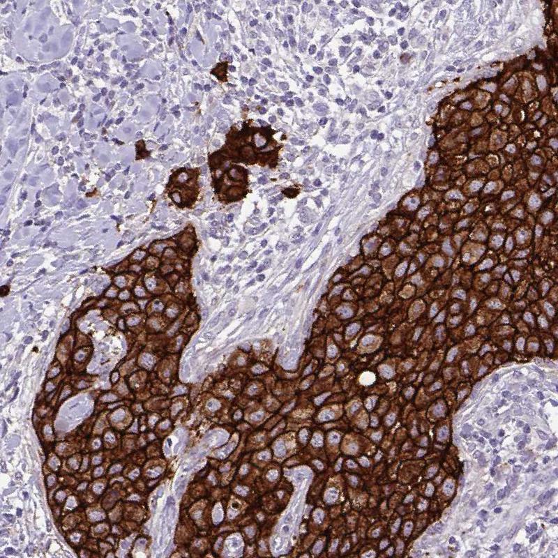 Atlas Antibodies Anti-HER2 Antibody
