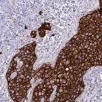 Atlas Antibodies Anti-HER2 Antibody