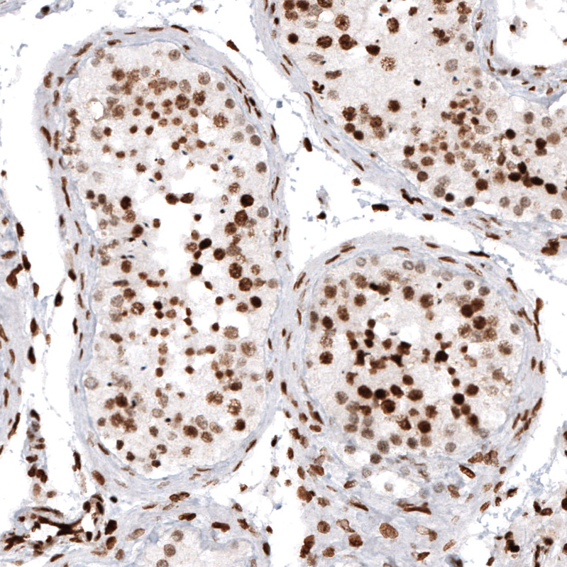 Atlas Antibodies Anti-HIST1H2AG Antibody