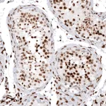 Atlas Antibodies Anti-HIST1H2AG Antibody