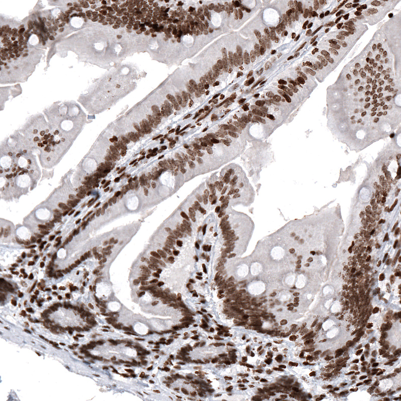 Atlas Antibodies Anti-HIST1H2AG Antibody