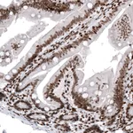 Atlas Antibodies Anti-HIST1H2AG Antibody