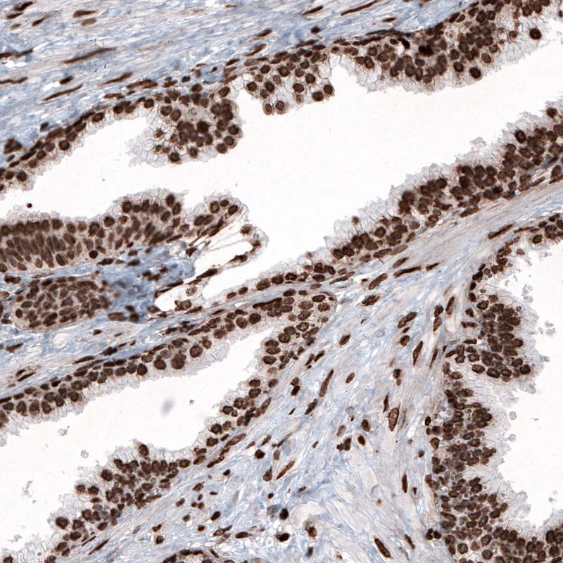Atlas Antibodies Anti-HIST1H2BC Antibody