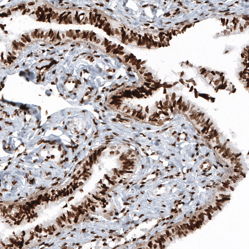 Atlas Antibodies Anti-HIST1H2BC Antibody