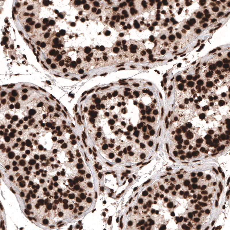 Atlas Antibodies Anti-HIST1H3A Antibody
