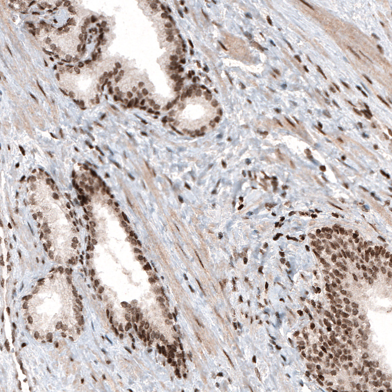 Atlas Antibodies Anti-HIST1H3A Antibody