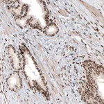 Atlas Antibodies Anti-HIST1H3A Antibody
