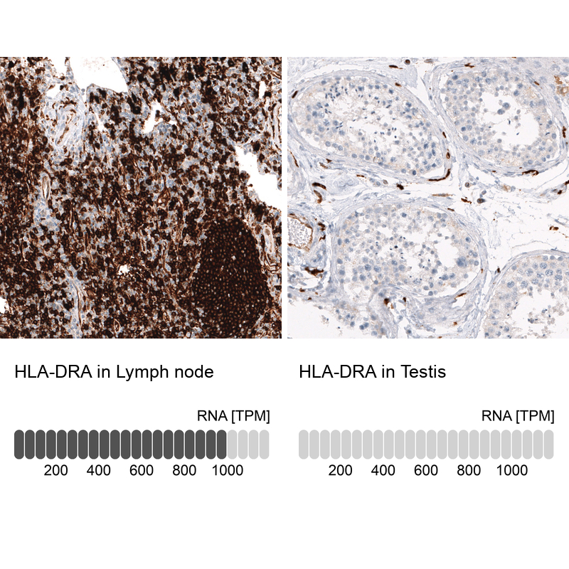 Atlas Antibodies Anti-HLA-DRA Antibody