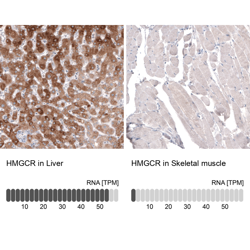 Atlas Antibodies Anti-HMGCR Antibody