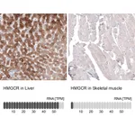 Atlas Antibodies Anti-HMGCR Antibody