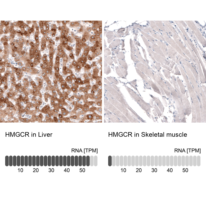 Atlas Antibodies Anti-HMGCR Antibody