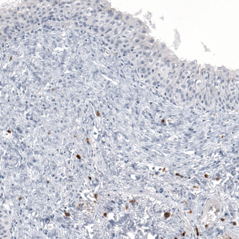 Atlas Antibodies Anti-IL17A Antibody