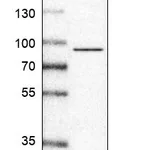 Atlas Antibodies Anti-IL17RA Antibody