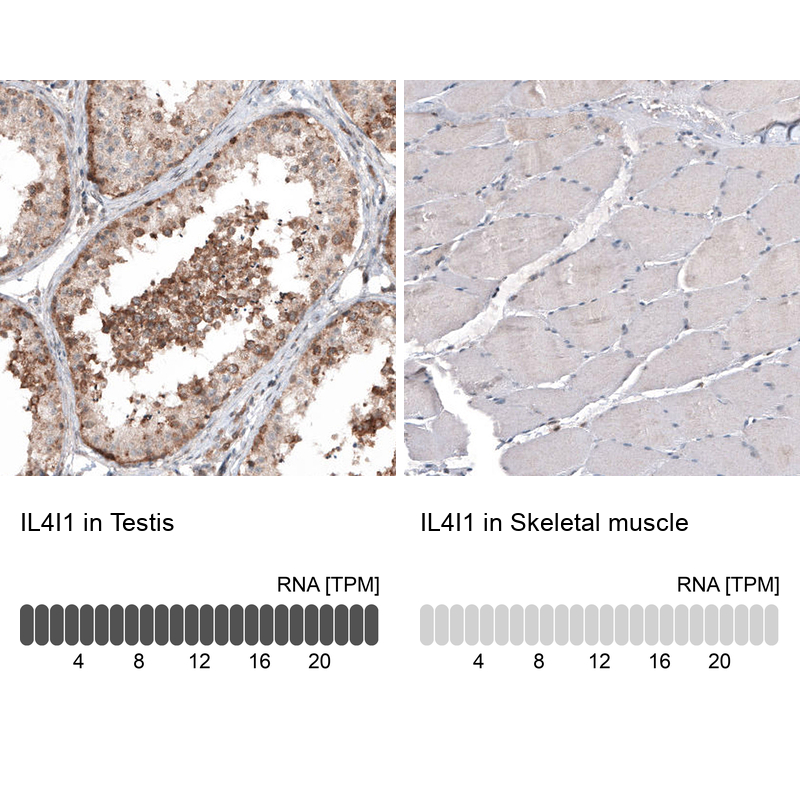Atlas Antibodies Anti-IL4I1 Antibody