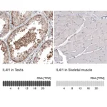 Atlas Antibodies Anti-IL4I1 Antibody