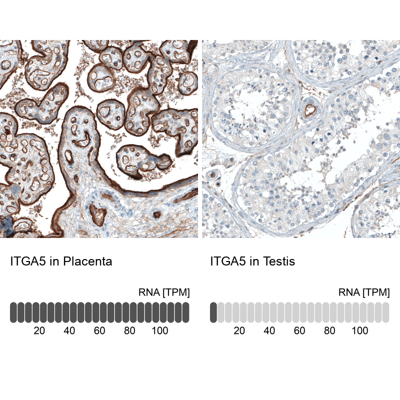 Atlas Antibodies Anti-ITGA5 Antibody