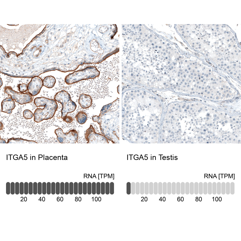Atlas Antibodies Anti-ITGA5 Antibody