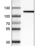 Atlas Antibodies Anti-ITGB3 Antibody