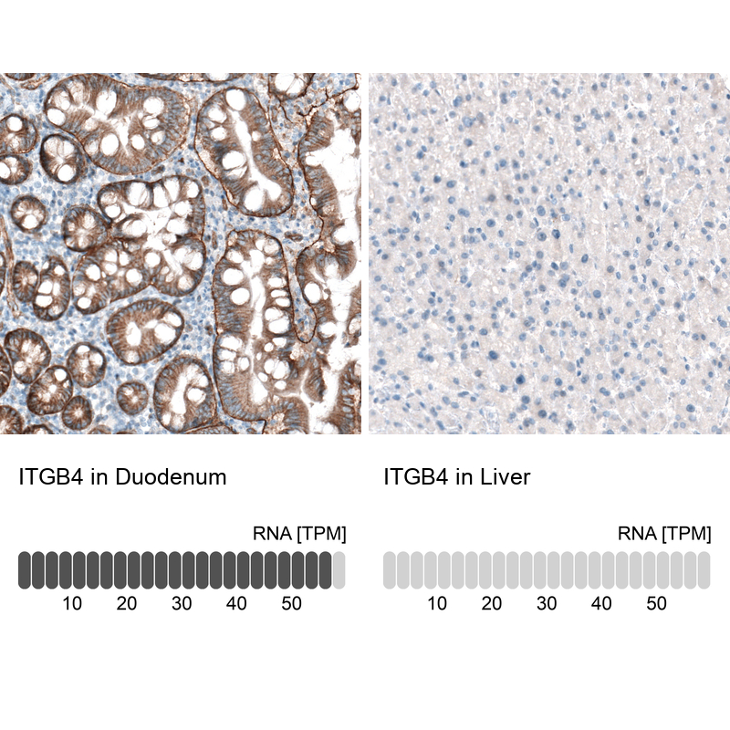 Atlas Antibodies Anti-ITGB4 Antibody