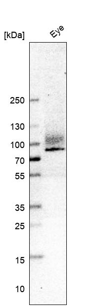 Atlas Antibodies Anti-ITGB8 Antibody