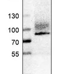 Atlas Antibodies Anti-ITGB8 Antibody