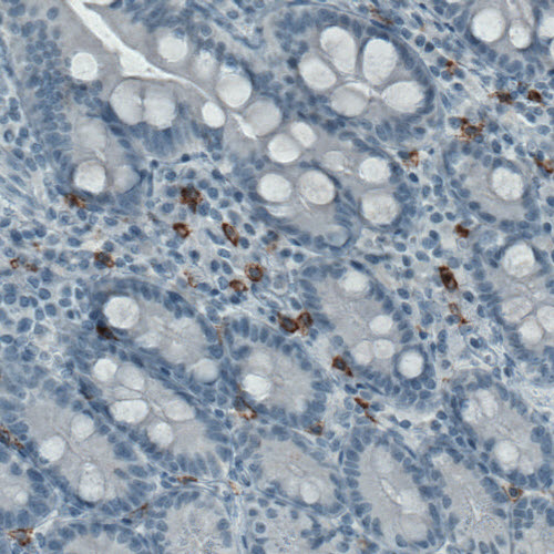 Atlas Antibodies Anti-KIT Antibody