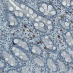 Atlas Antibodies Anti-KIT Antibody