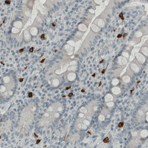 Atlas Antibodies Anti-KIT Antibody