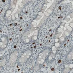 Atlas Antibodies Anti-KIT Antibody