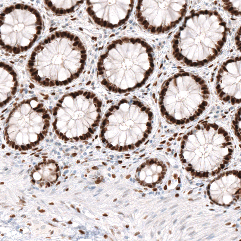 Atlas Antibodies Anti-KLF4 Antibody