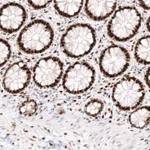 Atlas Antibodies Anti-KLF4 Antibody