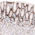 Atlas Antibodies Anti-KLF4 Antibody