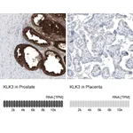 Atlas Antibodies Anti-KLK3 Antibody