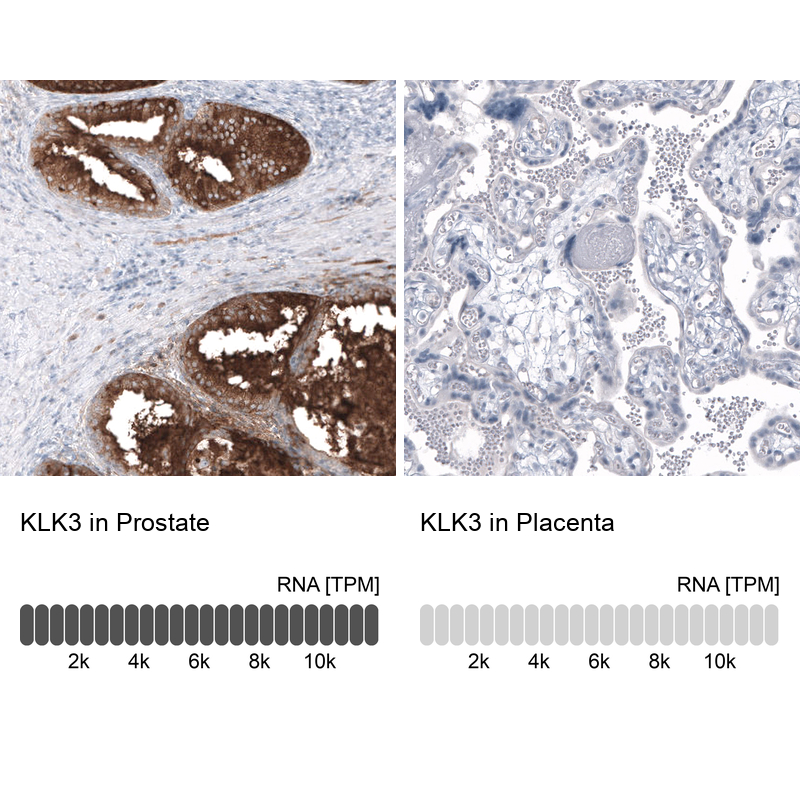 Atlas Antibodies Anti-KLK3 Antibody
