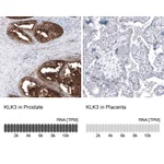 Atlas Antibodies Anti-KLK3 Antibody