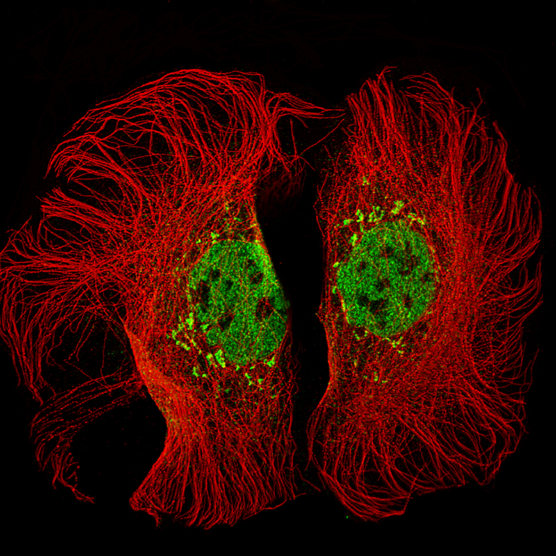 Atlas Antibodies Anti-KMT2D Antibody
